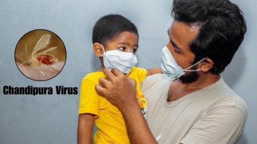 Chandipura Virus