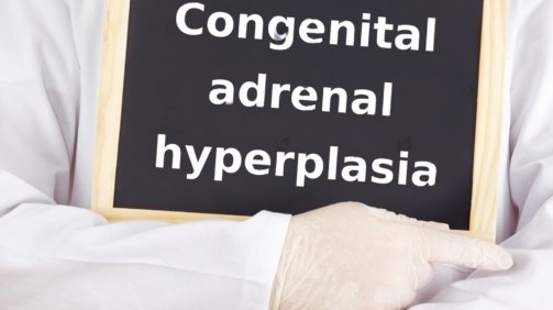 Congenital Adrenal Hyperplasia